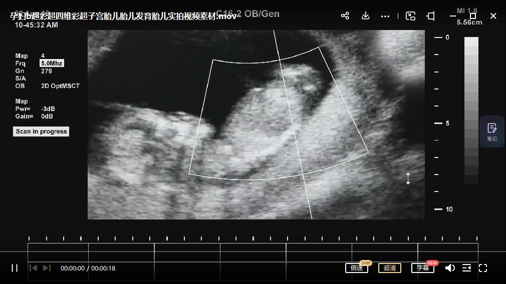 图片[3]|最新抖音快手蓝海无人直播胎教助眠玩法，轻松引爆直播间【教程+软件+素材】|52搬砖-我爱搬砖网